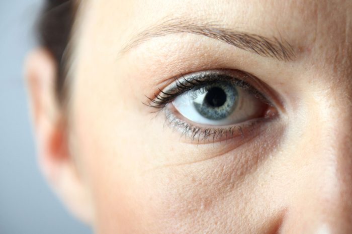 closeup of woman's eye with puffiness