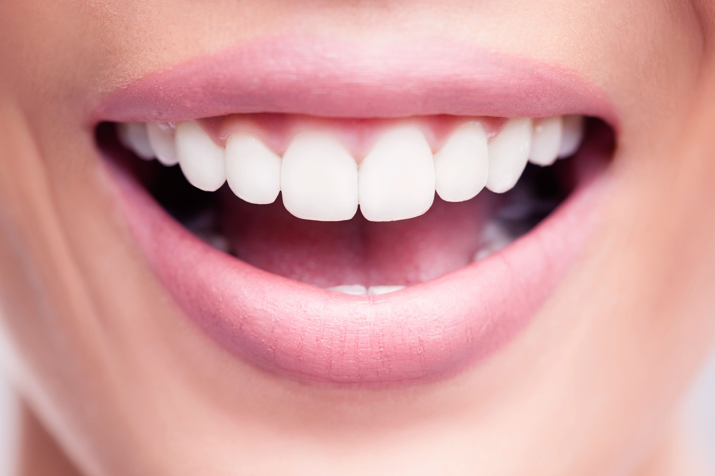 woman's perfect teeth