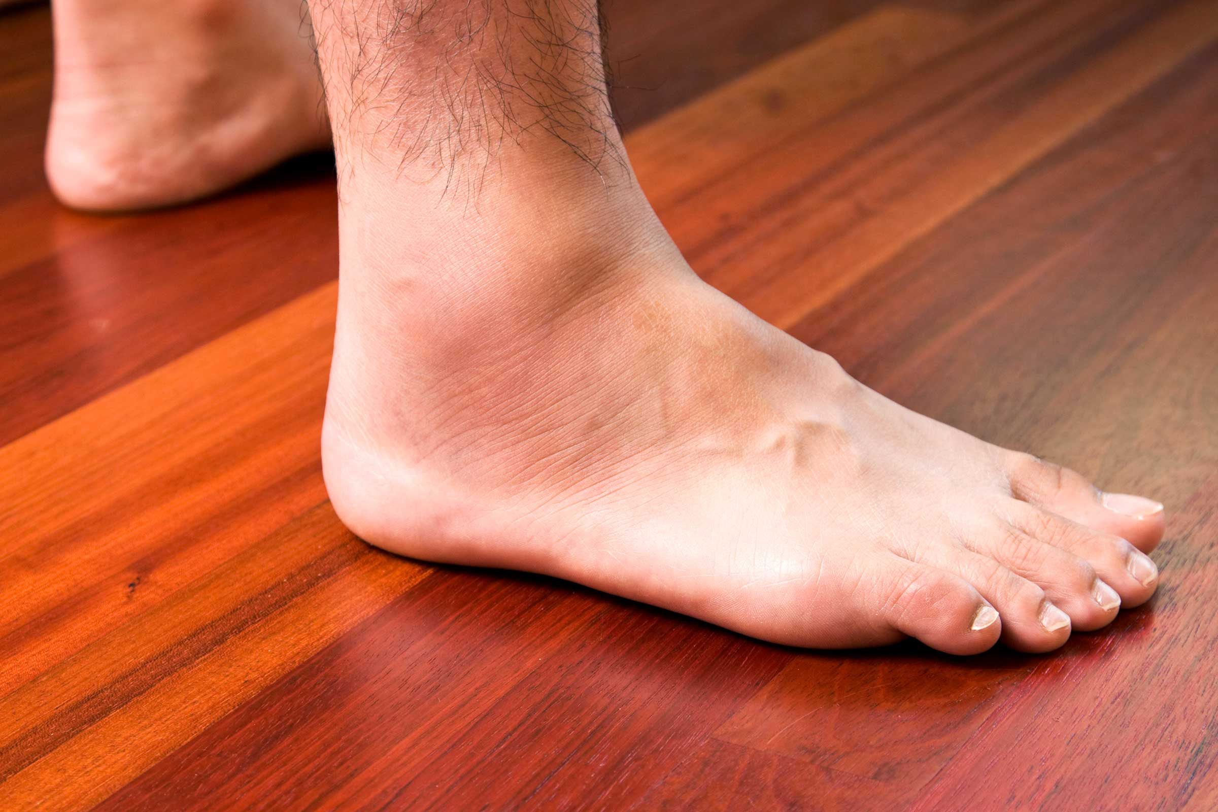 feet