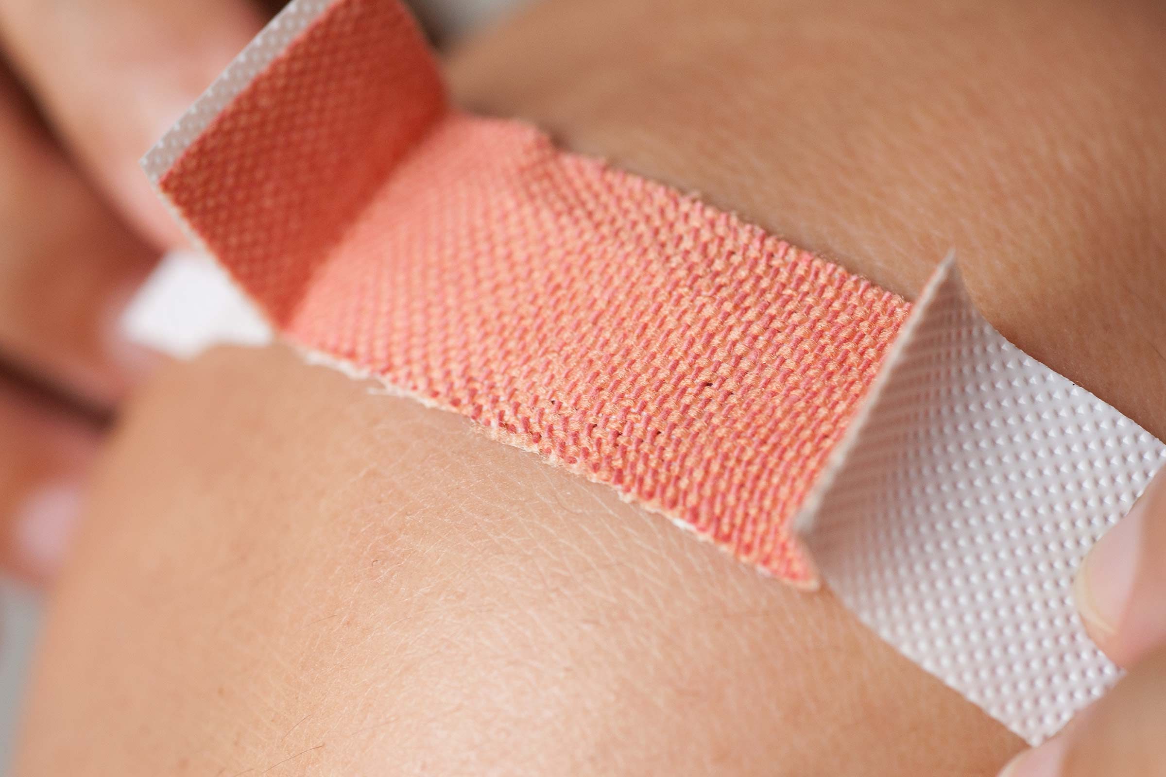 03-is-that-cut-or-scrape-infected