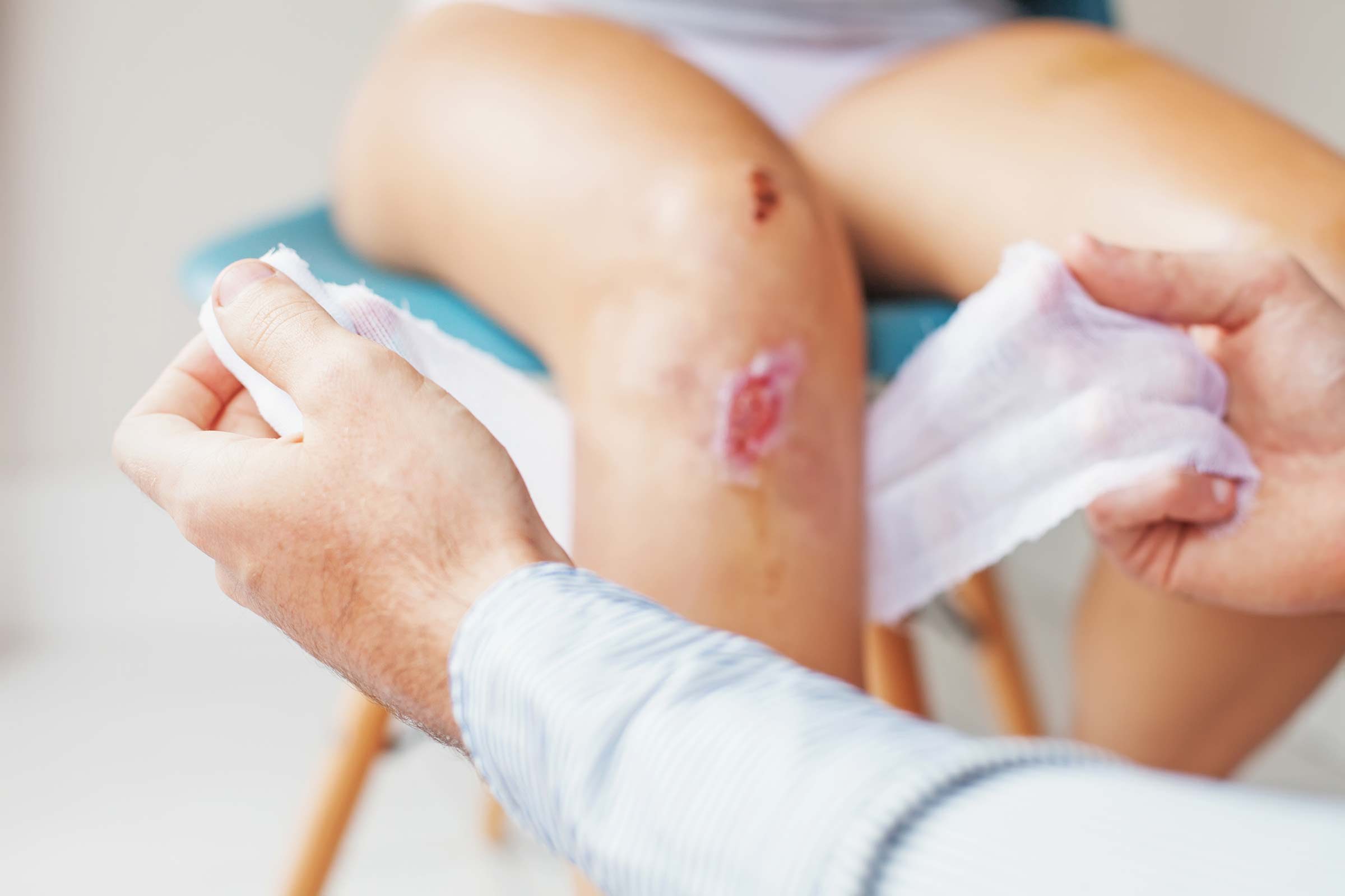 04-is-that-cut-or-scrape-infected