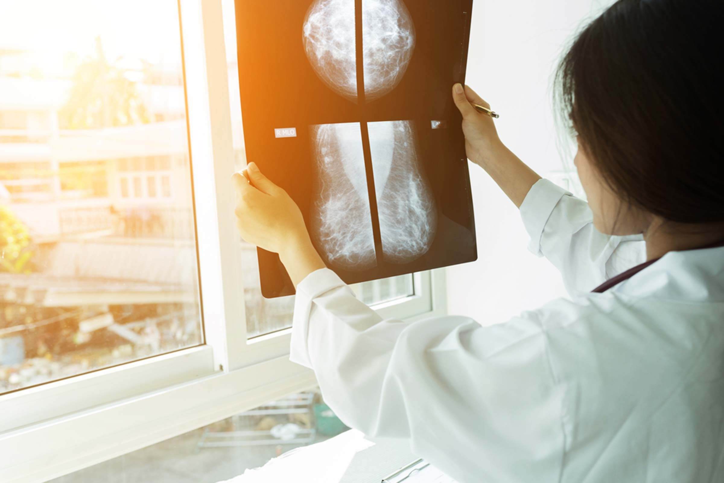 mamogram