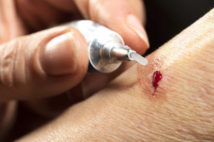closeup of hands applying neosporin to a cut