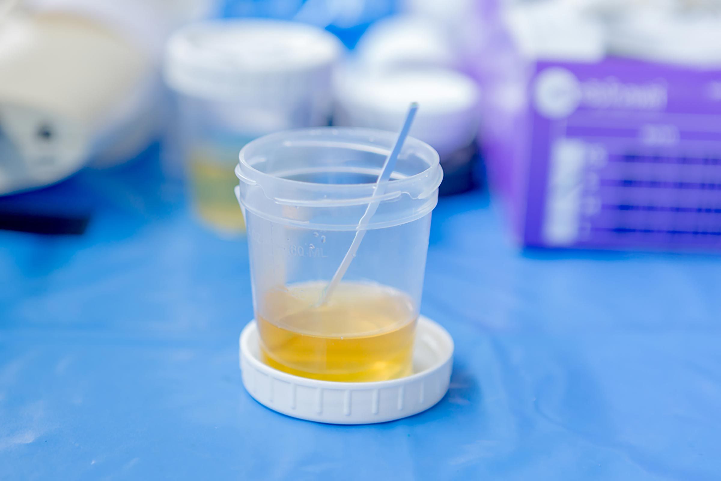 urine