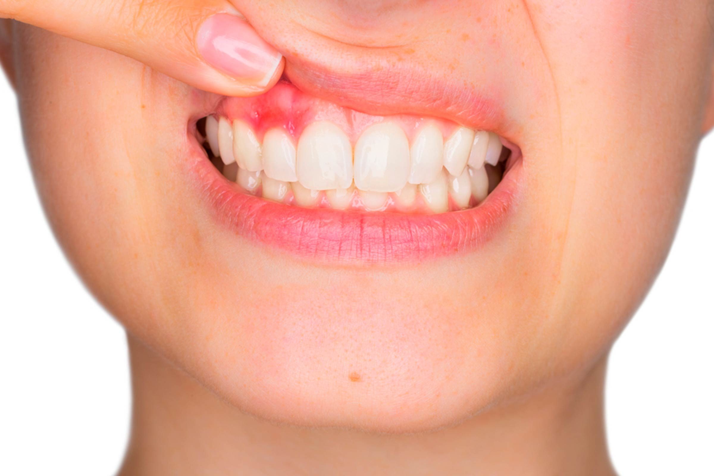 Things-Your-Dentist-Wants-You-to-Know-(But-You're-Too-Scared-to-Ask)
