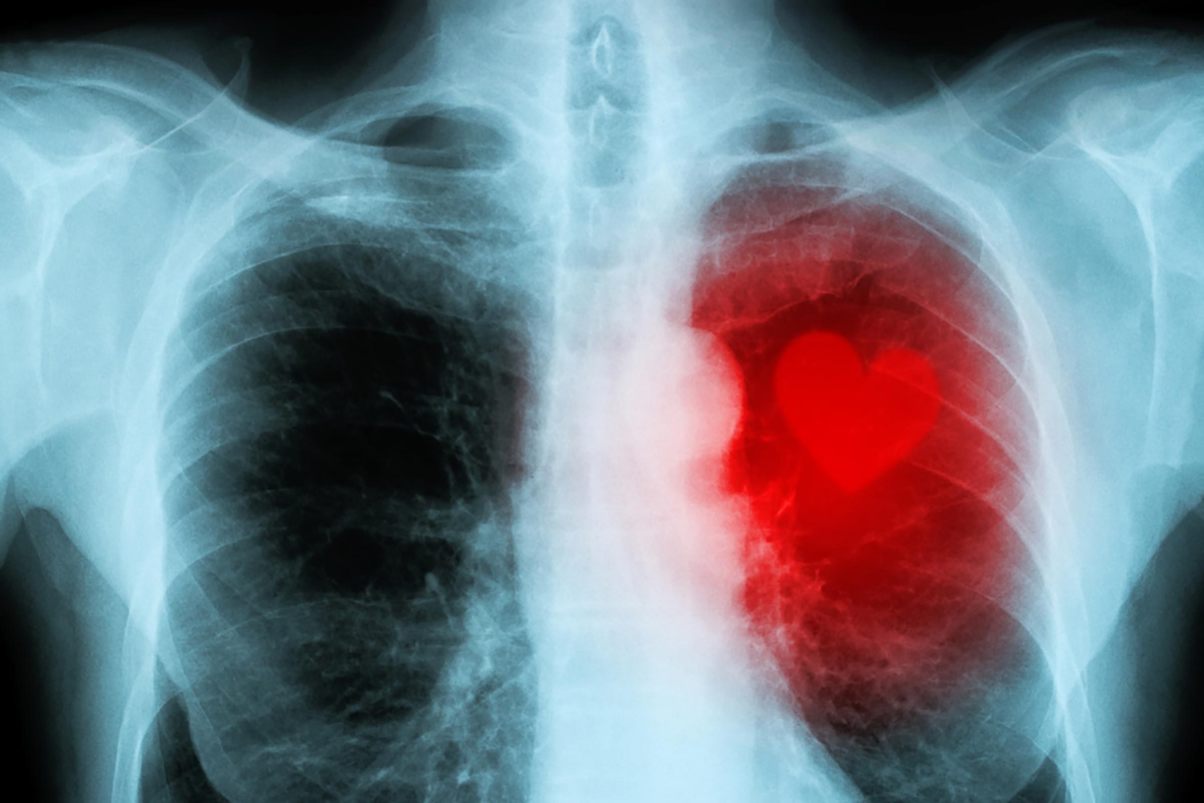 heart