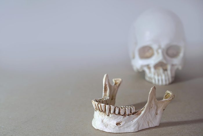 skeletal jaw and skull, separated.