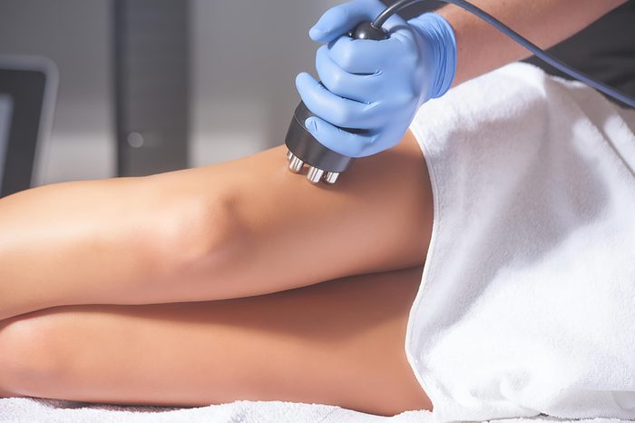 Cellfina treatment