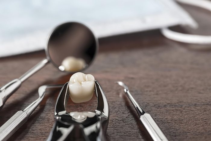 dental pliers holding an extracted molar
