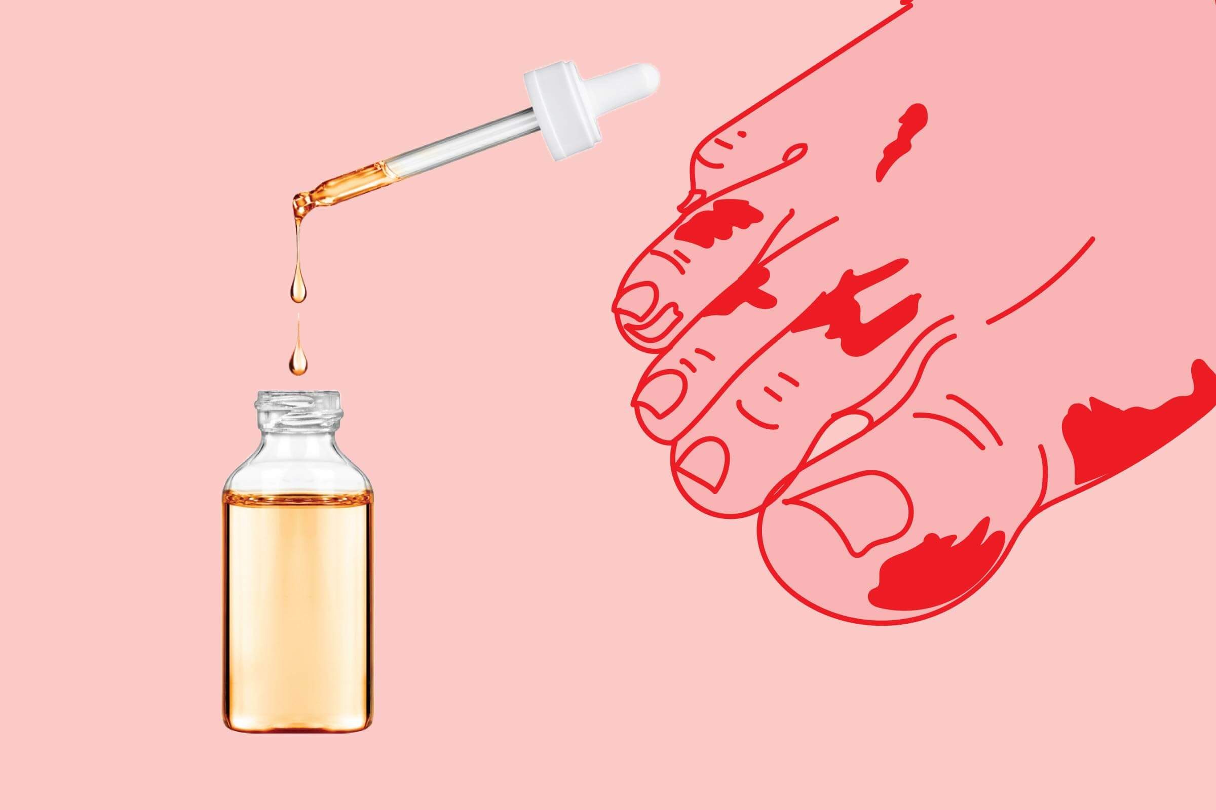illustration of a foot with hotspots with photo of dropper and bottle
