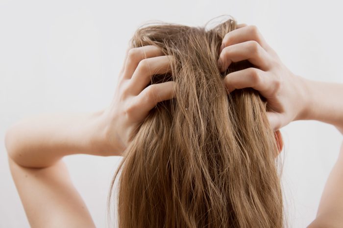 woman with dry itchy scalp