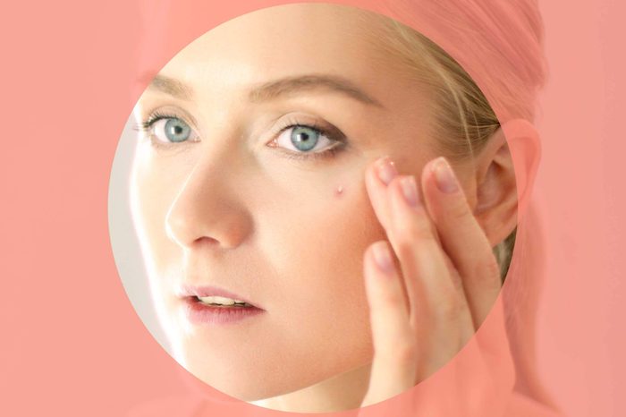 Woman looking in the mirror at a whitehead on her cheek