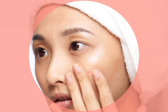 Asian woman checking out a whitehead on her cheek.