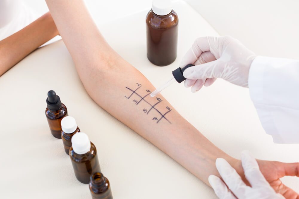 Doctor doing skin allergy test at her patient in medical office
