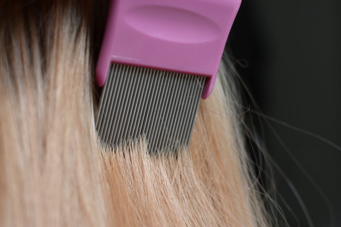 lice treatment close up of hair