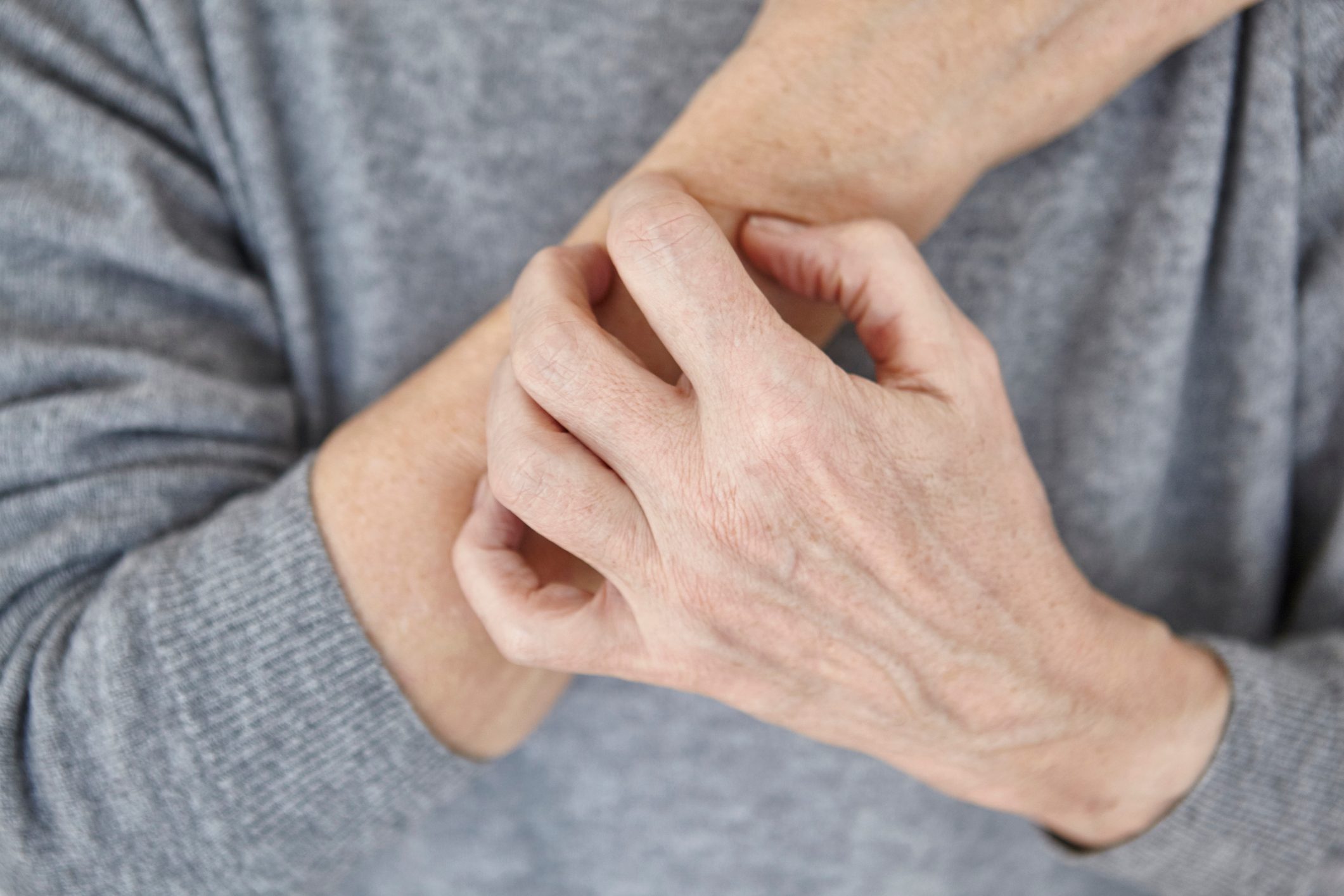close up of woman scratching arm