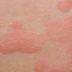 10 Strange Skin Problems That Could Be a Sign of a Serious Disease