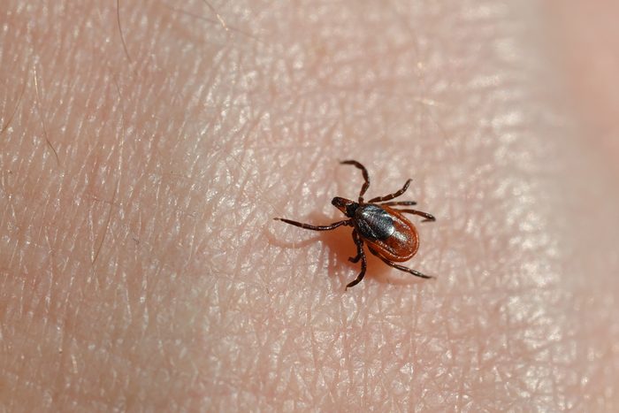 Ixodes scapularis tick crawling on skin