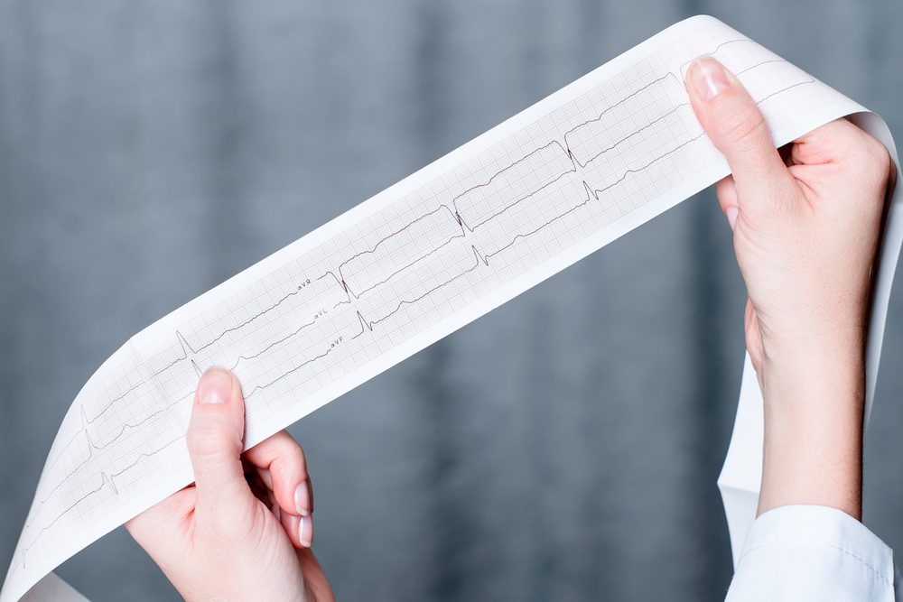 Electrocardiogram, ecg in hand, palm of a doctor. Medical health care. Clinic cardiology heart rhythm and pulse test closeup. Cardiogram printout. 
