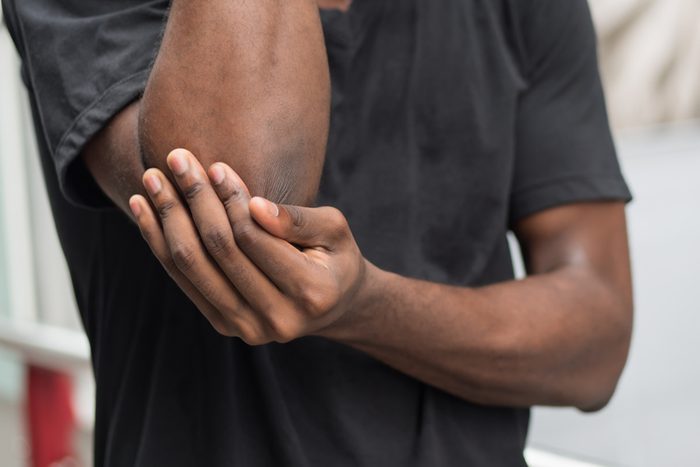 african man suffering from elbow pain; sick black man with elbow joint pain, osteoporosis, bone arthritis, gout, symptoms; body sickness, health care or pain concept; adult african man or model