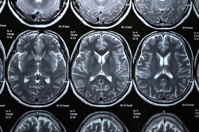 MRI Scaner Film