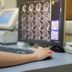 The 10 Most Common Types of Cancer in the United States
