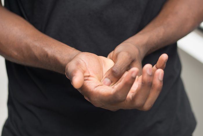 african man suffering from wrist or hand pain; sick black man with cps wrist pain, trigger finger, bone arthritis, gout symptoms; sickness, health care or pain concept; adult african man model
