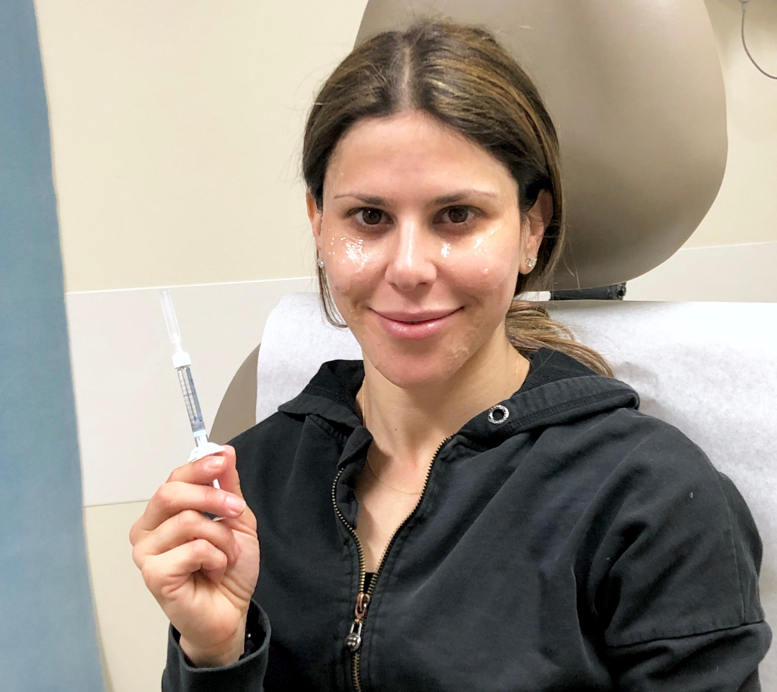 restylane lyft