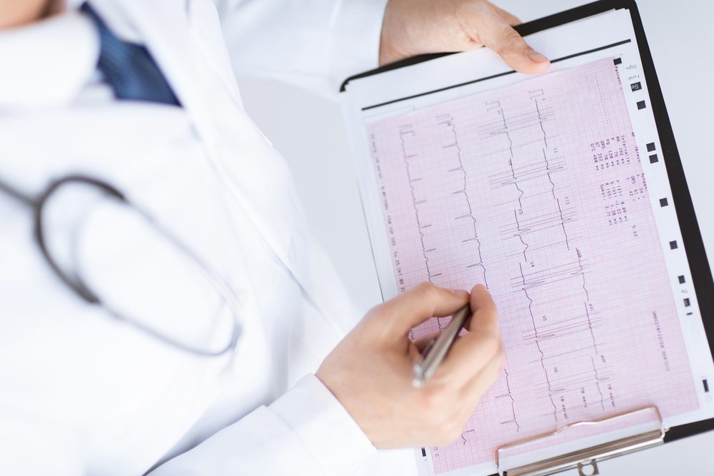 bright picture of male doctor hands with cardiogram