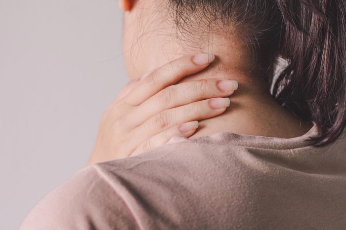 neck rash
