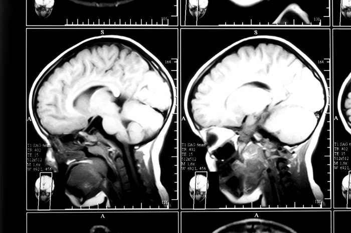 X-ray image of the brain computed tomography