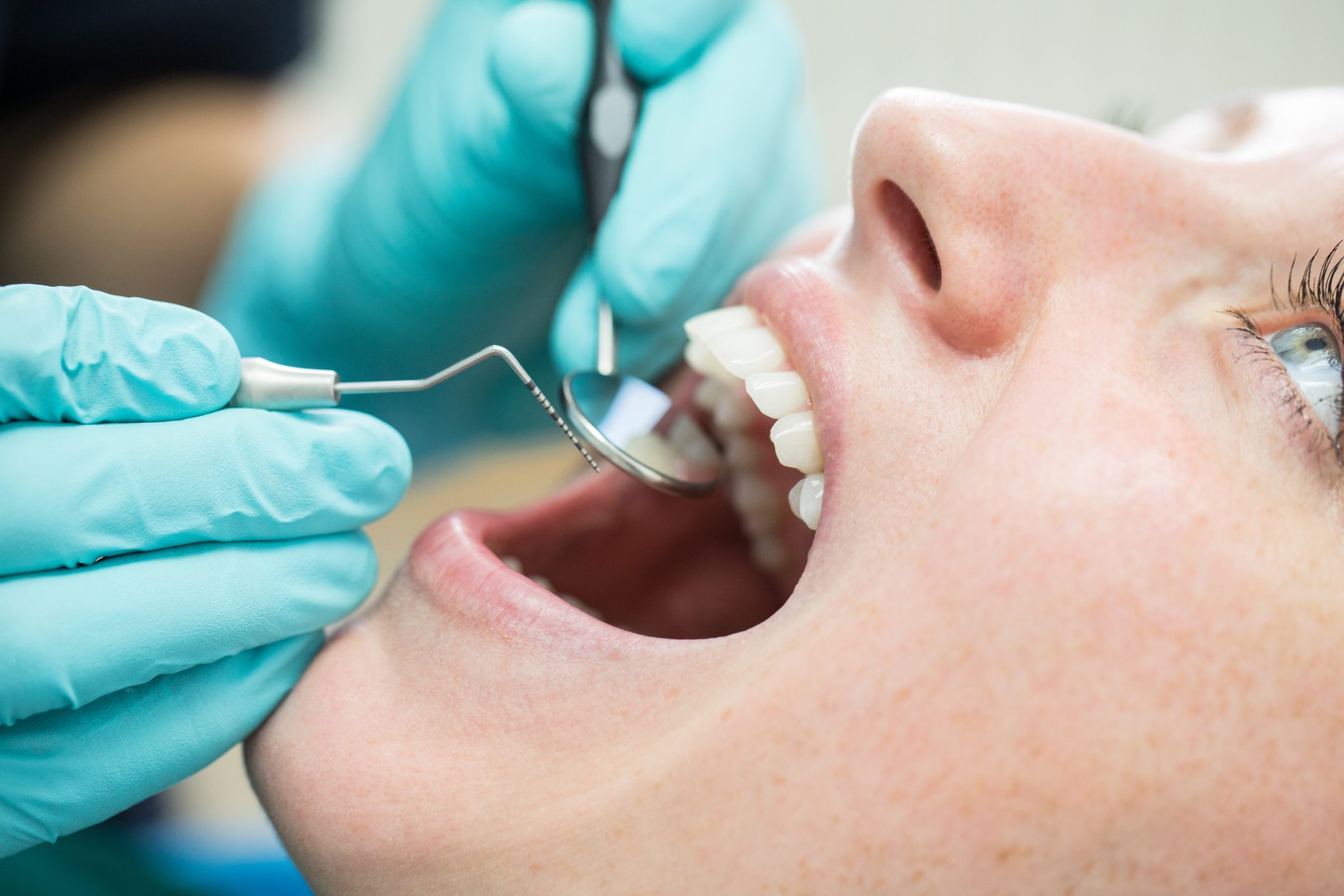 dentist checking patient's teeth