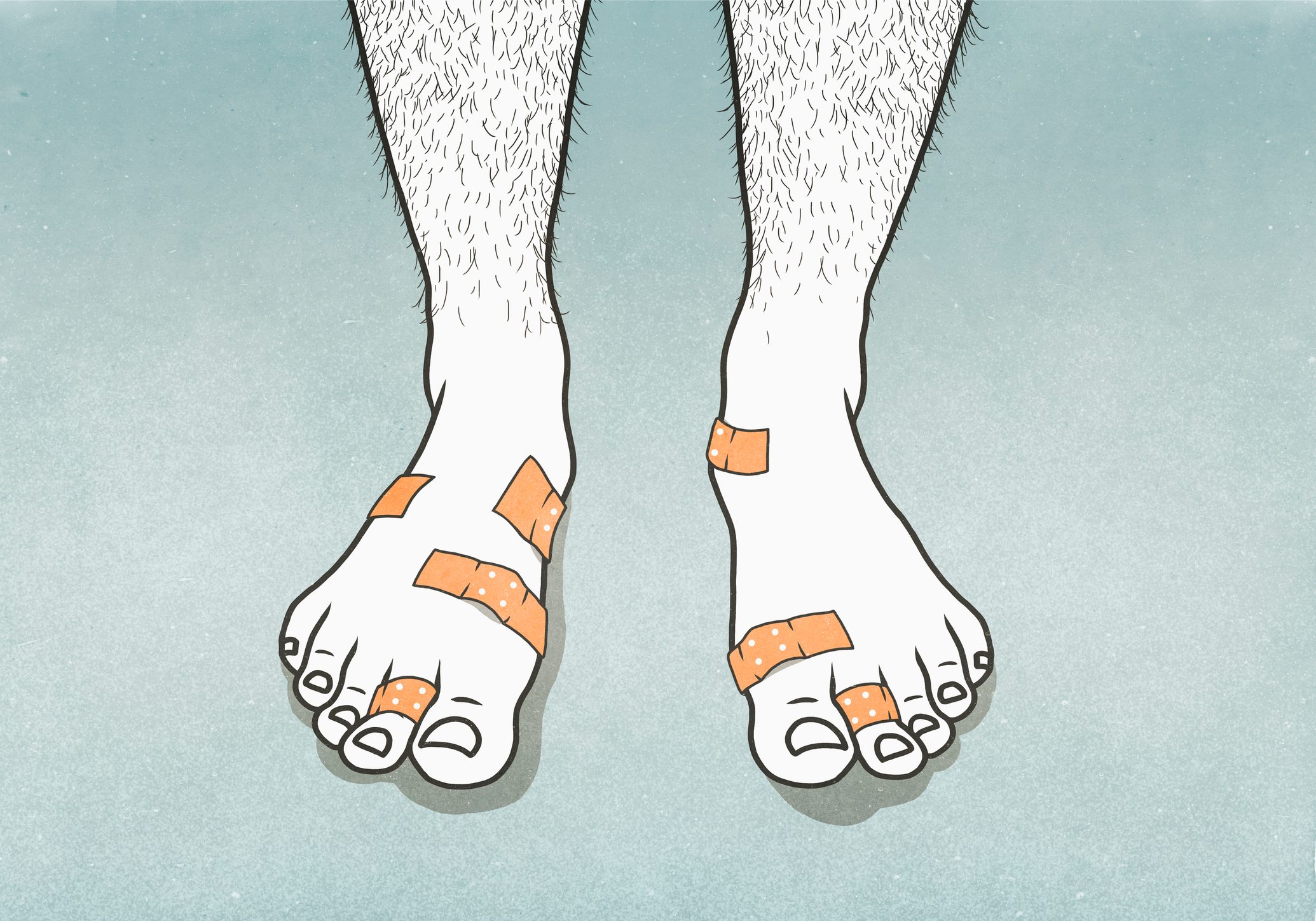 Bandages covering blisters on mans feet