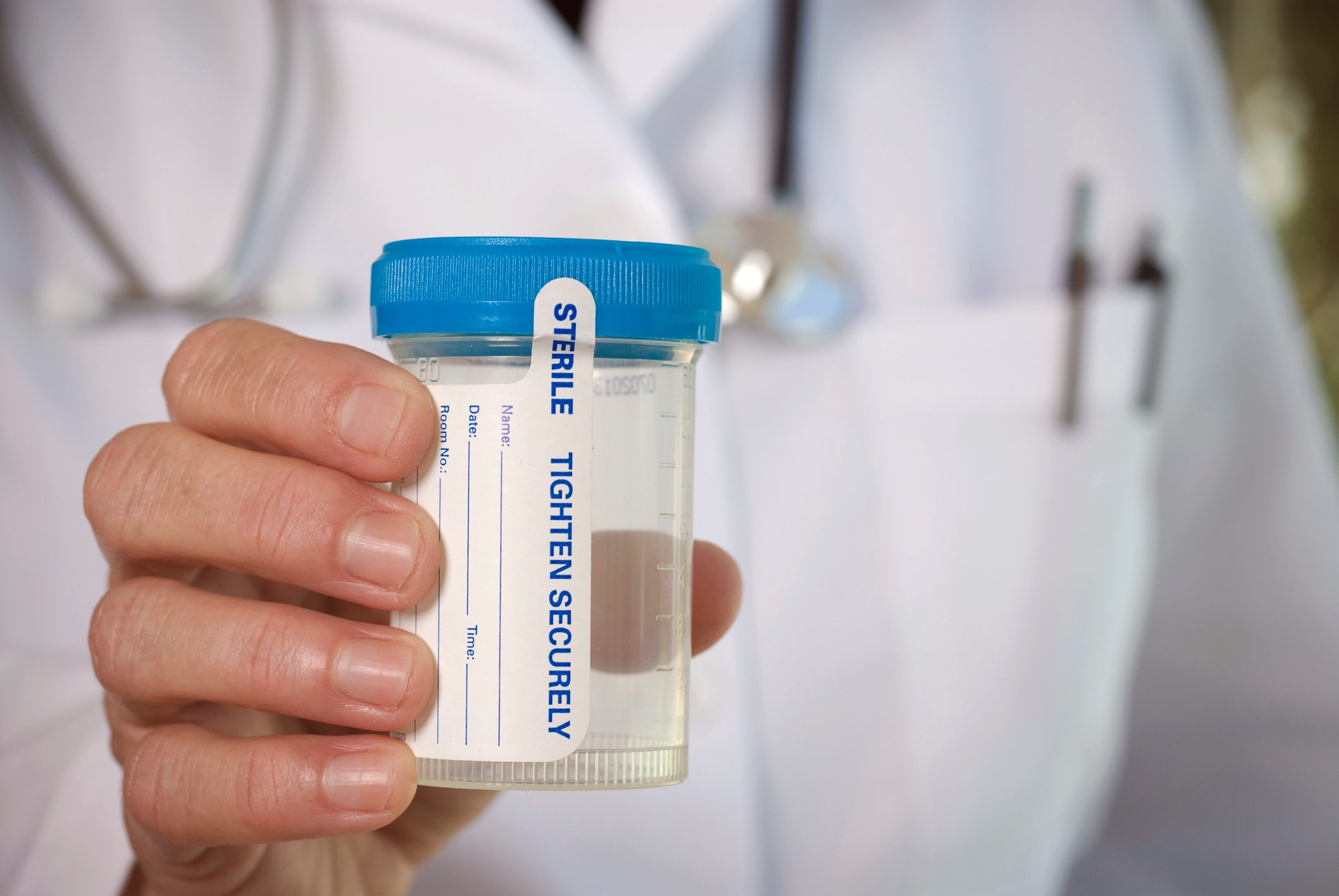 doctor holding empty urine test cup