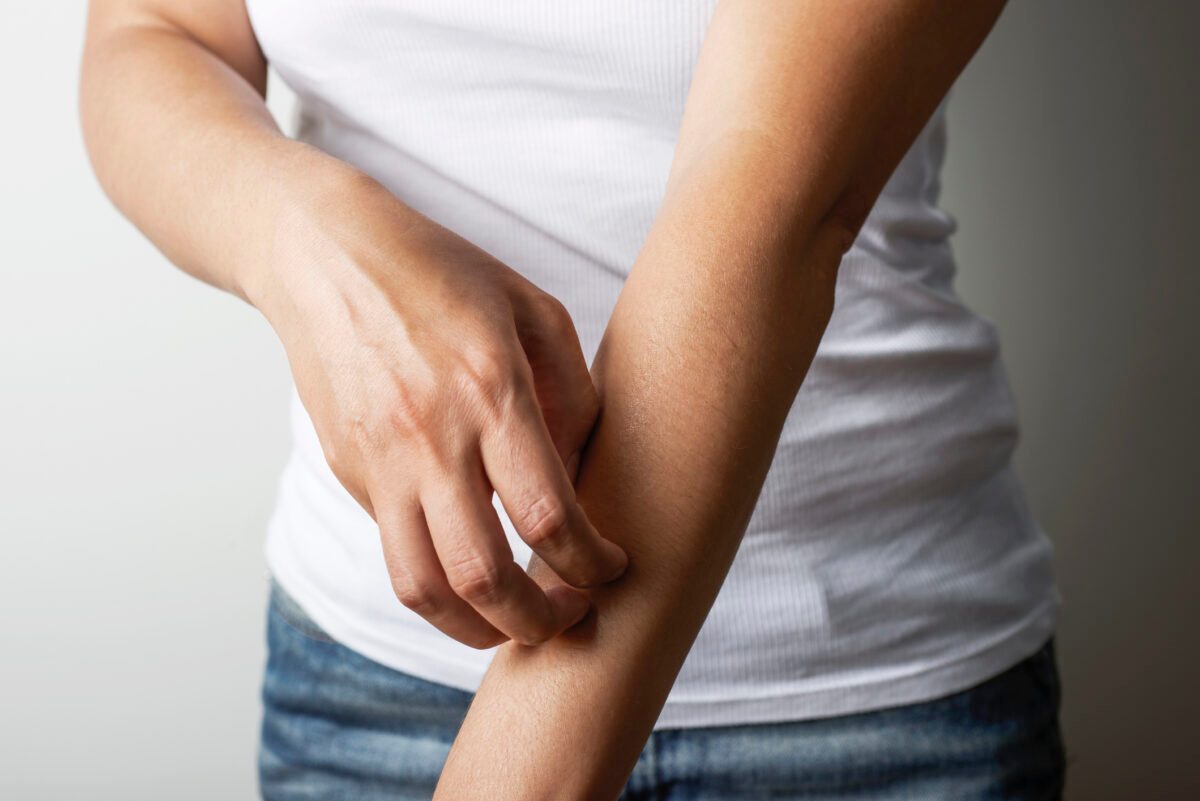 Is It Hives or a Rash? Here’s How to Tell the Difference