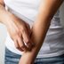 Is It Hives or a Rash? Here's How to Tell the Difference