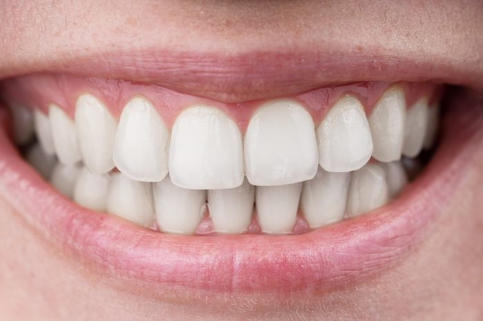 Close-up of a perfect female smile. Macro.