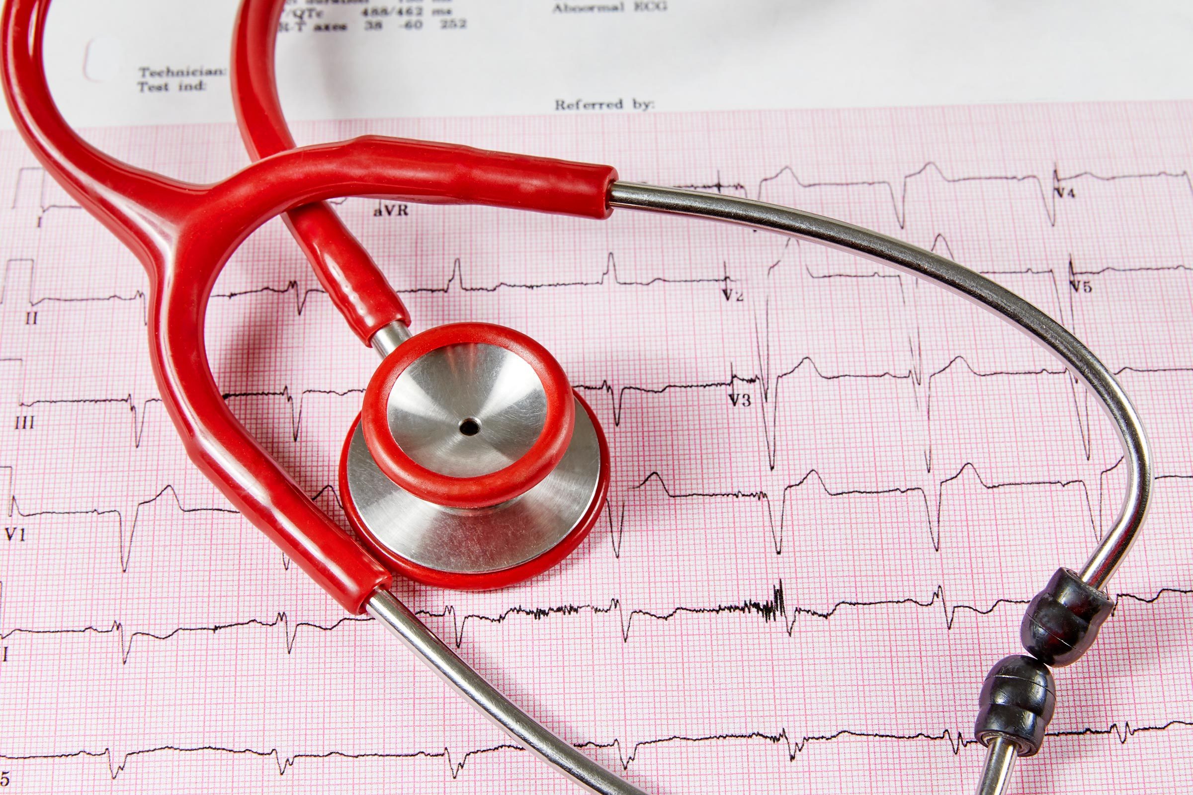 Abnormal Echocardiograph Report with a Red Stethoscope
