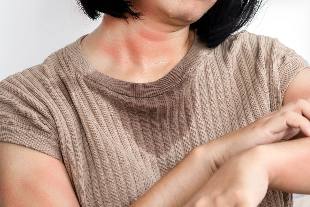 Woman With Sweat And Rash Skin