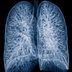 More Than 80% of People Who Need This Cancer Screening Aren't Getting It