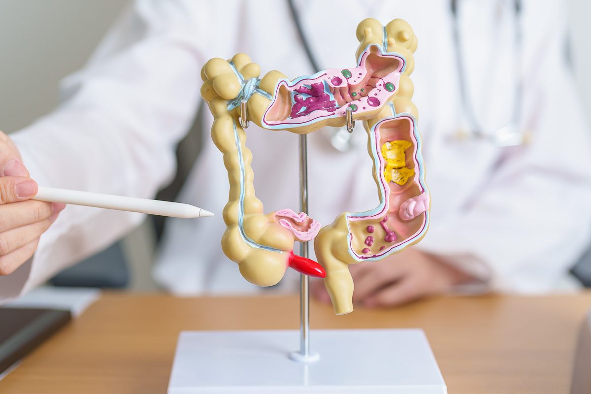 doctor pointing to model of human colon
